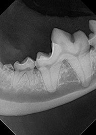 dental x-ray
